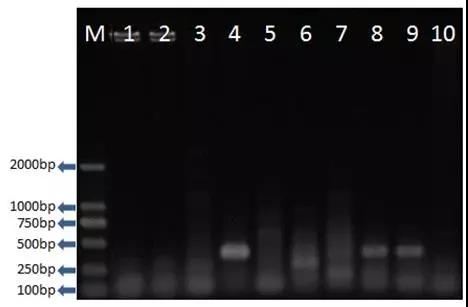 【案例】一起保育猪混淆熏染蕴厥狻毒、蓝耳病毒及细菌的案例-专家效劳-河南邦农饲料有限公司